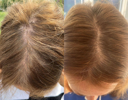 Crown & Bloom™ - Follicle Stimulating + DHT Blocking Botanical Hair Growth Serum