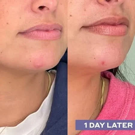 Daily SOS Rescue Hypochlorous Acid Facial Spray - Delune 
